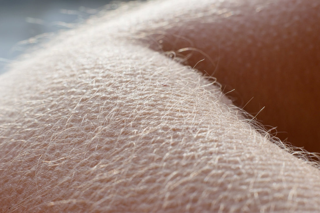 "Flex Your Skin: The Muscle Behind Goosebumps!"** - Jolie Clinic
